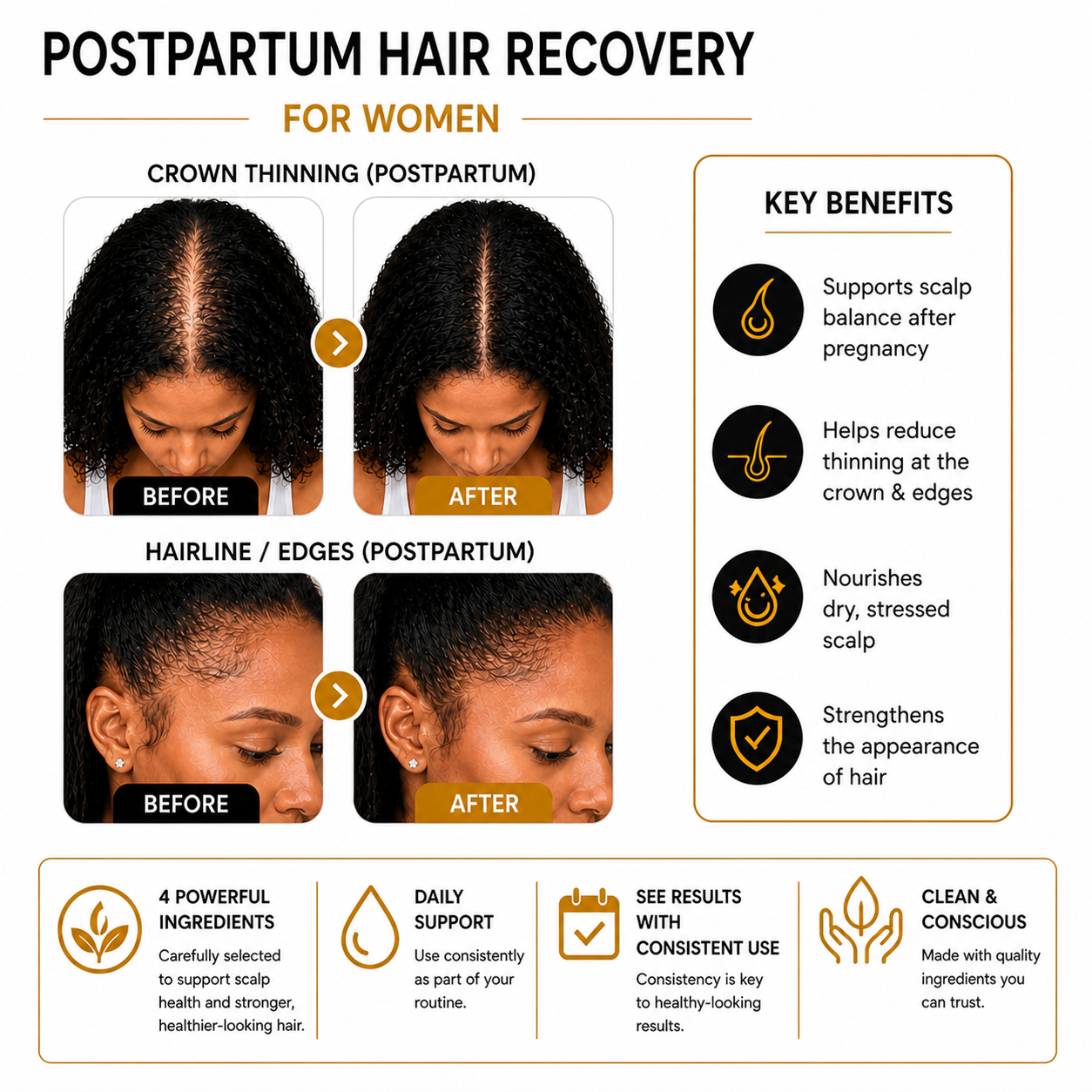 Kalyra Scalp Recovery Serum